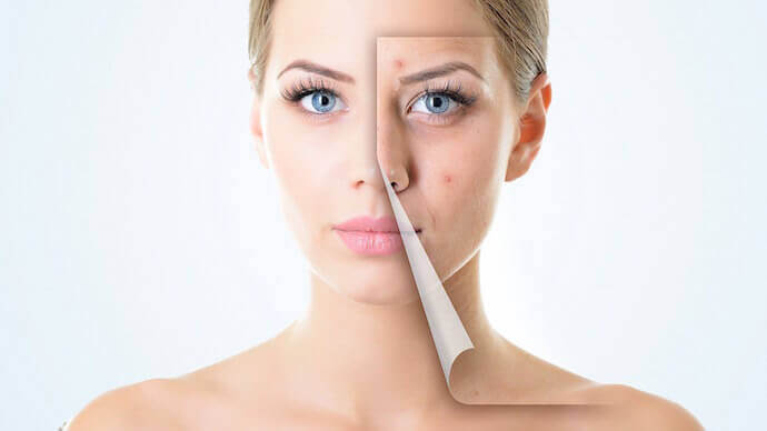 Quá trình bong da của magic skin như thế nào?