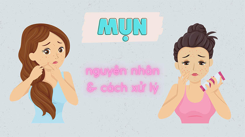 Nguyên nhân gây mụn ở từng vị trí trên mặt, cách điều trị như thế nào?