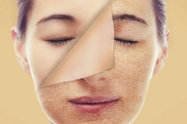 Tẩy tế bào chết tại nhà cho da mặt: những sai lầm thường mắc phải