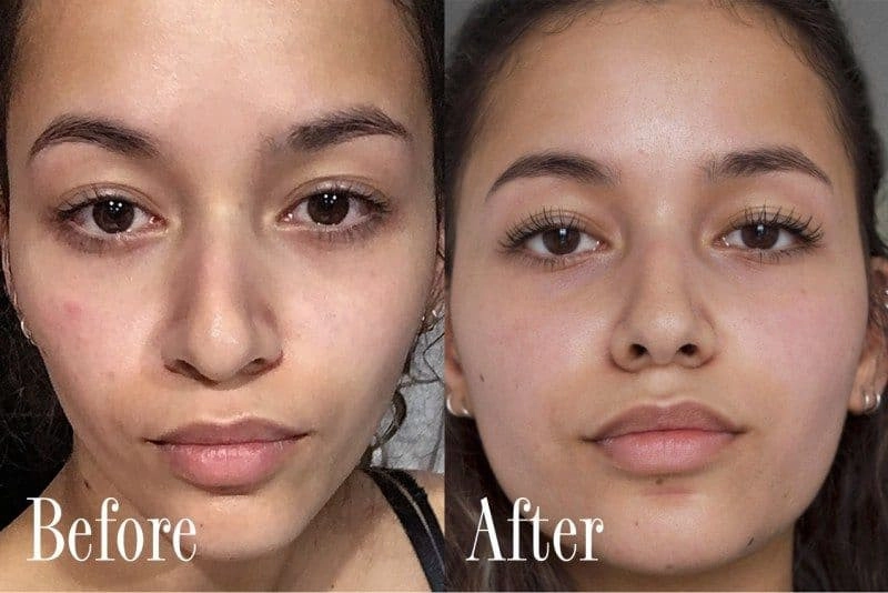 Top 5 serum tái tạo da tốt nhất nên mua 2023