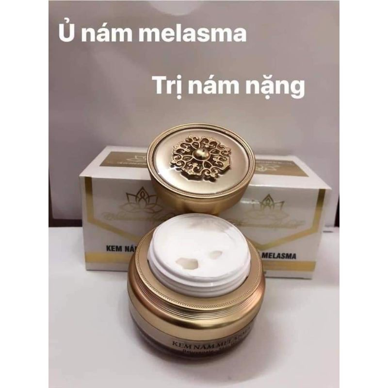 Kem Ủ Nám Melasma Chamomileskill có tốt không?