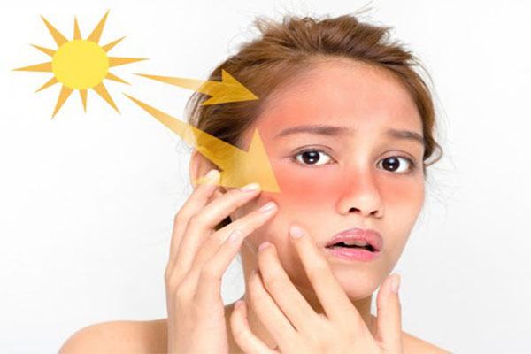 Tránh ánh sáng mặt trời chiếu và chiếu trực tiếp trong vòng 24 giờ